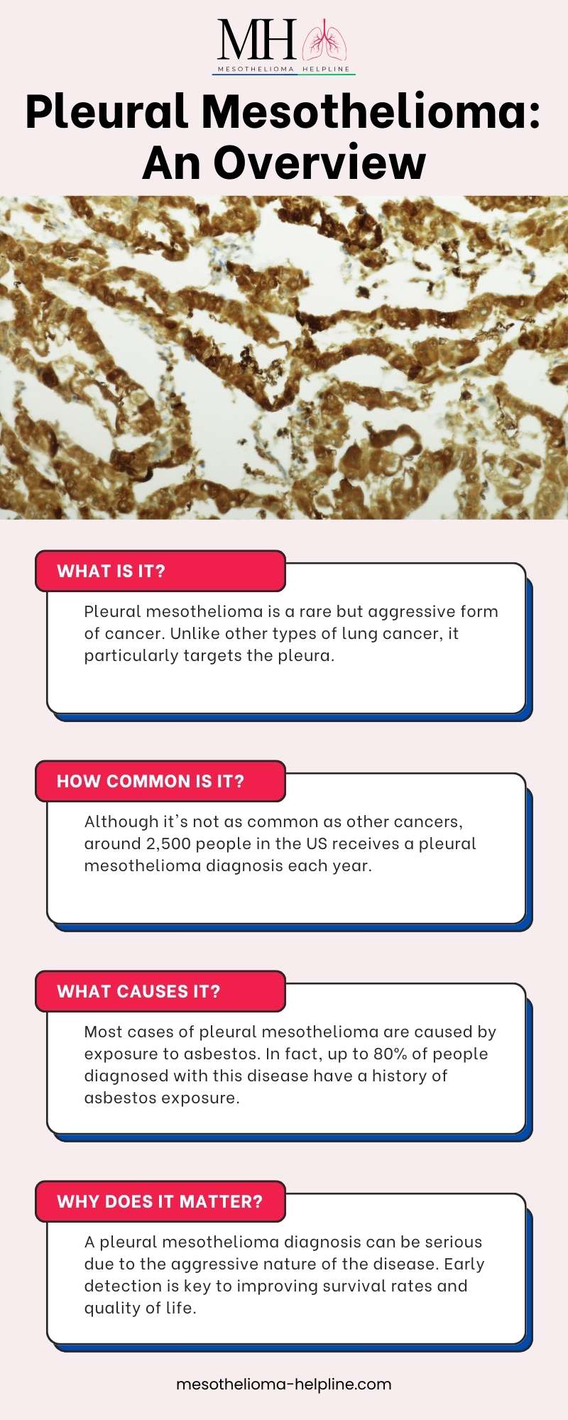 How Pleural Mesothelioma Diagnosis | Aware