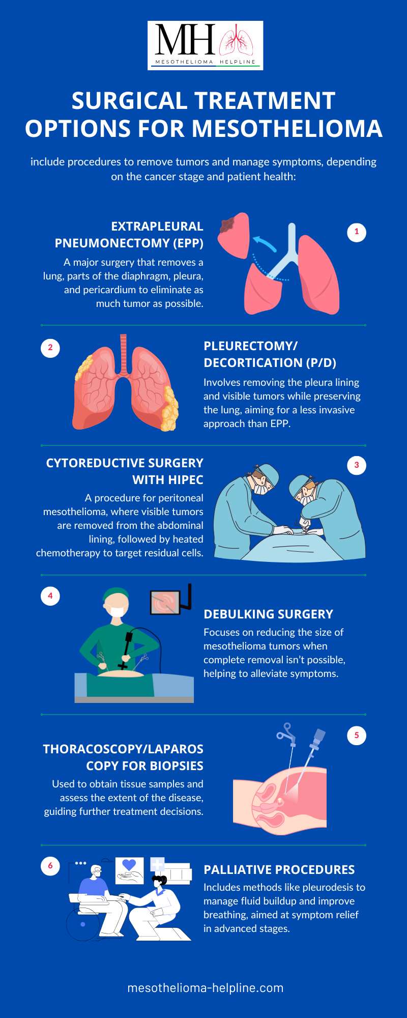 Best Treatment Options for Mesothelioma Cancer