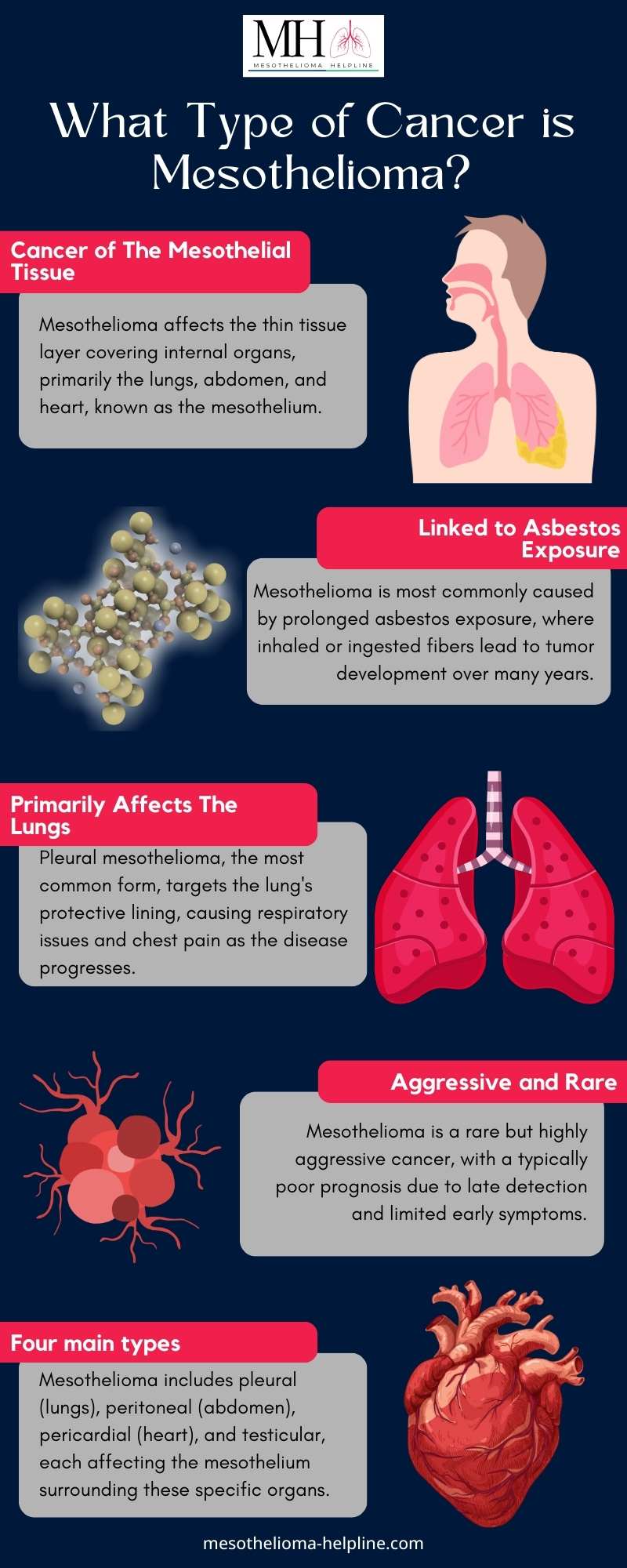 What Type of Cancer is Mesothelioma?